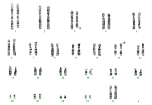 insertie 3-11