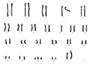 trisomie 21