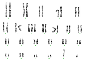 trisomie 8