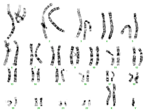 trisomie XXY + inv 9